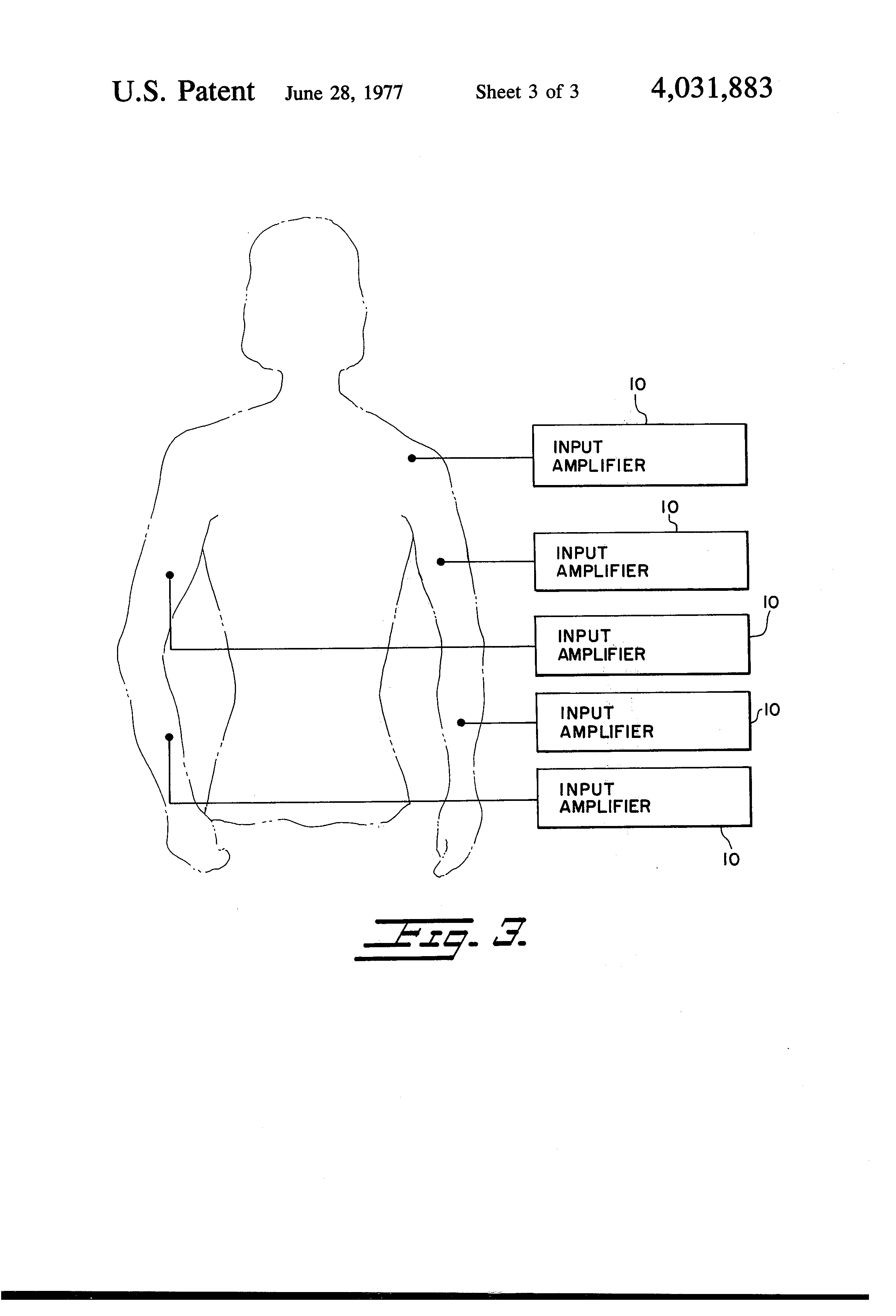 Fehmi Phase-Integrating Biofeedback Computer archival photograph