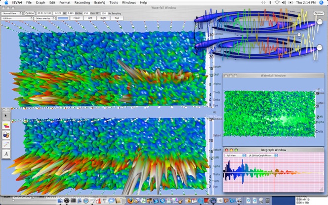IBVA software interface showing real-time brainwave spectral analysis on Macintosh