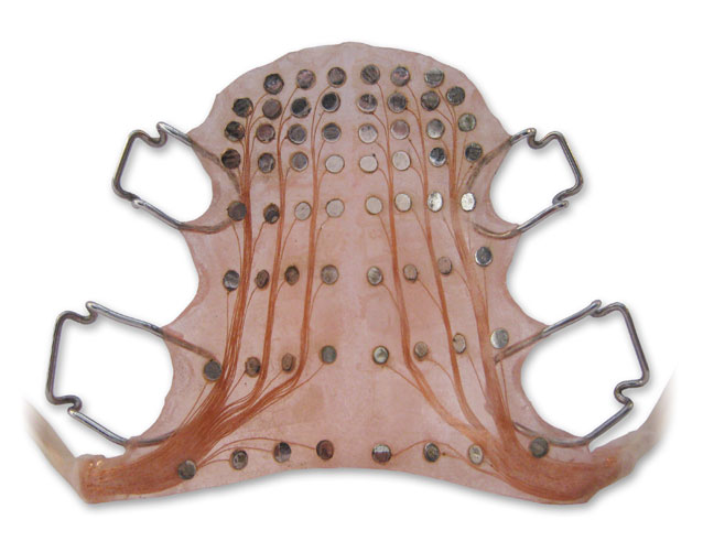 Modern 62-electrode Reading EPG palate on plaster cast