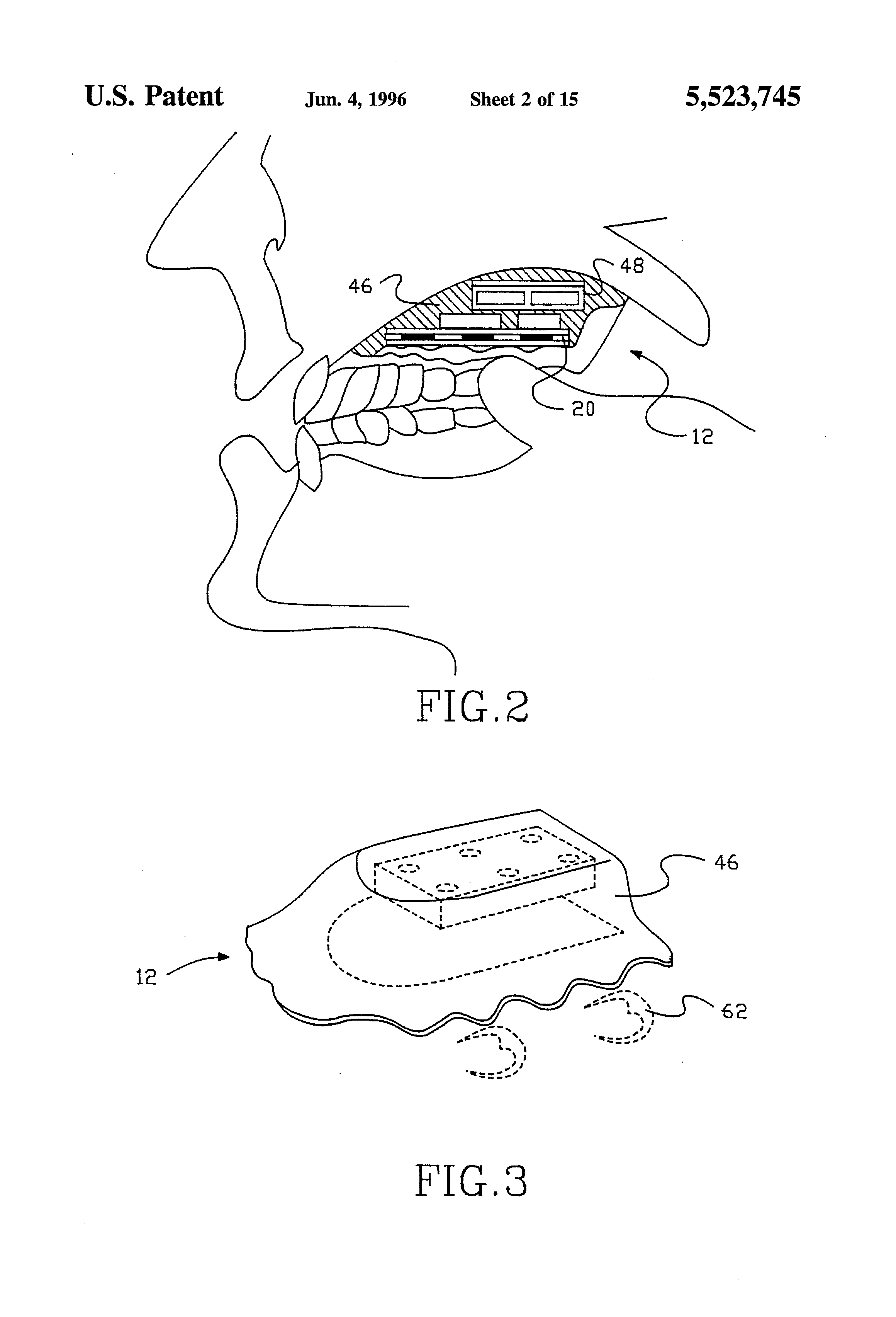 US Patent 5,523,745 Figure 1: block diagram of the tongue activated communications controller system