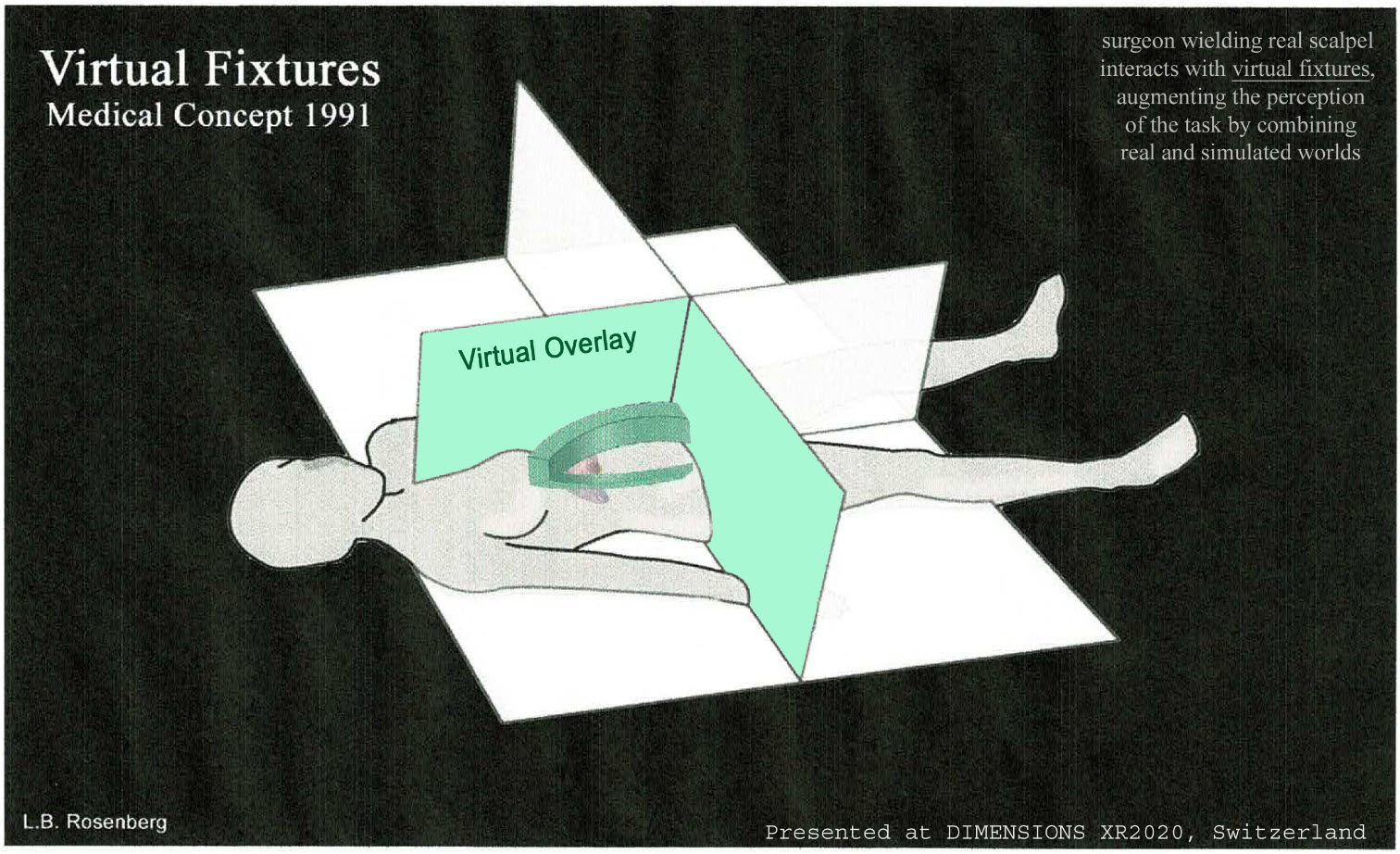 1991 concept drawing showing Virtual Fixtures applied to augmented surgery